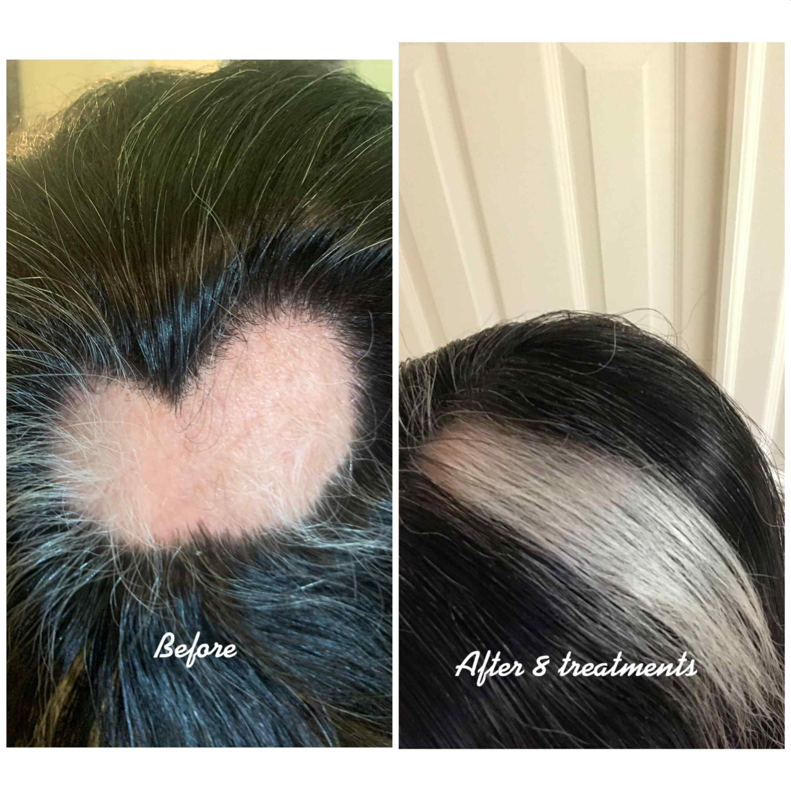 before-after-hair-rejuvination-pdf