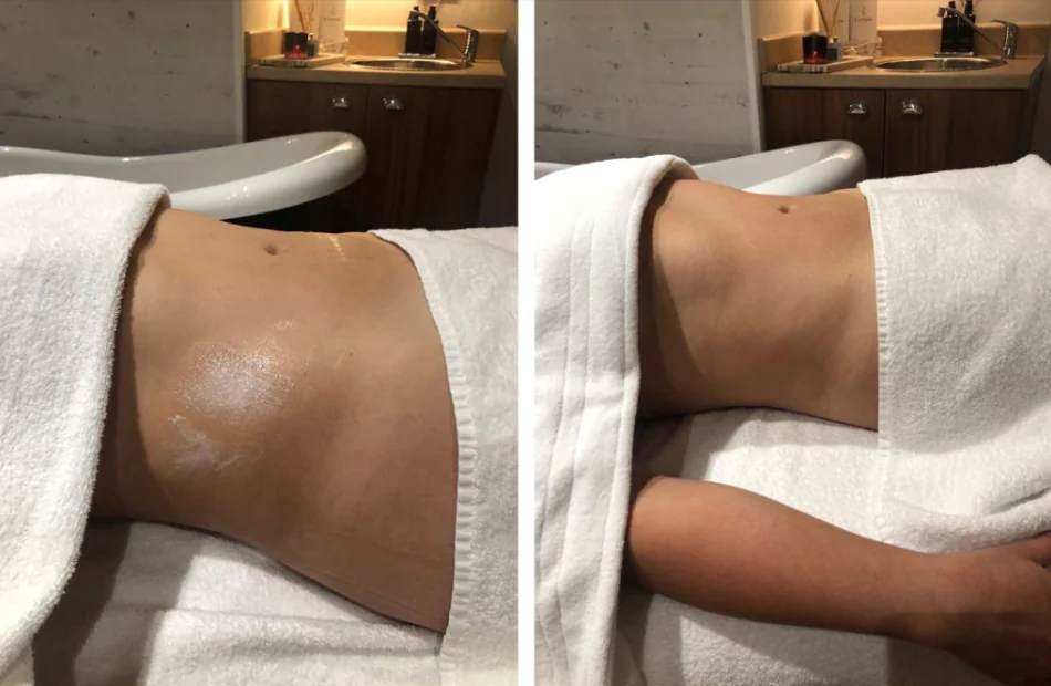 Before and after a lymphatic drainage session at our Creve Coeur studio